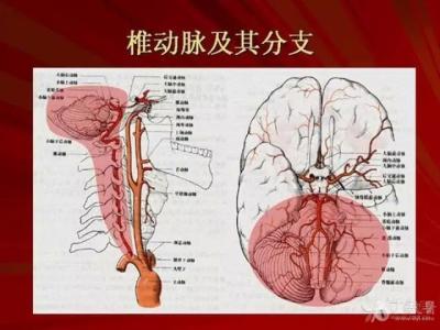 颈动脉脑血管中老年 脑血管解剖之颈内动脉及其分支