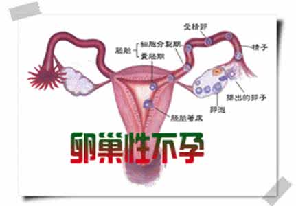 卵巢性不孕的主要因素 卵巢性不孕 卵巢性不孕的因素