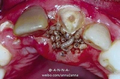 蝇蛆病得病前兆 蝇蛆病