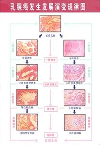 银行卡分为几种类型 子宫肌瘤保健操 女性保健 女性子宫肌瘤可以分为几种类型