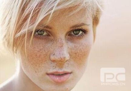黄褐斑很烦恼 你还在为黄褐斑烦恼吗？