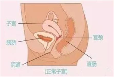 子宫前位容易怀孕吗 子宫前位是什么意思、容易怀孕吗