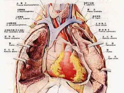 胸腺瘤有什么症状 什么是胸腺瘤 胸腺瘤的症状与治疗