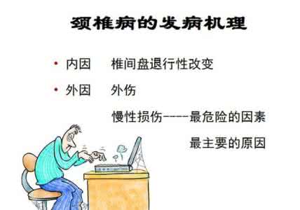 颈椎病自我按摩图解 颈椎病有何先兆 自我按摩疗法防治颈椎病