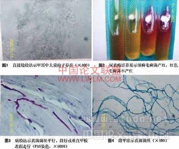 电子支气管镜检查图谱 《皮肤病性病直接镜检图谱》