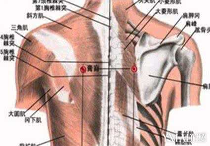 肩胛骨酸痛怎么办 肩胛骨酸痛 肩胛骨酸痛怎么办