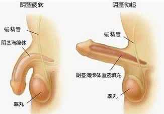 男性勃起功能障碍原因 性爱时男性勃起障碍能治好吗