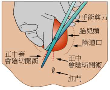 肛门坠胀怎么缓解 产后肛门坠胀怎么缓解?