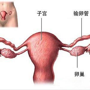 输卵管堵塞如何治疗好 输卵管堵塞的症状 输卵管堵塞如何治疗