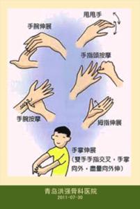 预防鼠标手 预防“鼠标手”的运动保健方法
