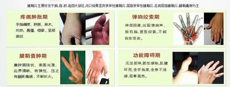 腱鞘炎和腱鞘囊肿区别 腱鞘炎和腱鞘囊肿有什么区别