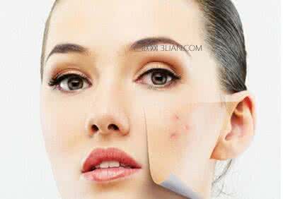 黄瓜敷脸能去痘印吗 脸上长痘怎么办_黄瓜敷脸去痘印