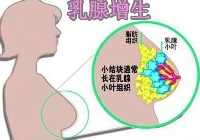 治疗乳腺疾病的医院 乳腺增生什么治疗 那些你该知道的乳腺疾病常识