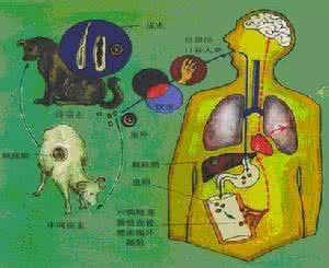 肝胆系统解剖图 肝胆系统寄生虫病
