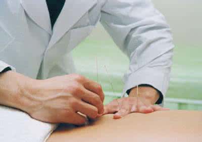 腰疼针灸几天能好 针灸治疗腰疼