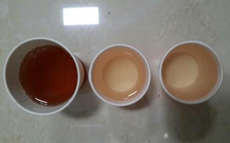 男性无痛血尿的原因 血尿的原因 这些原因均会引起血尿的出现