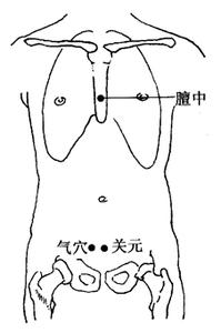 乳腺增生的刮痧疗法 月经后期的刮痧疗法