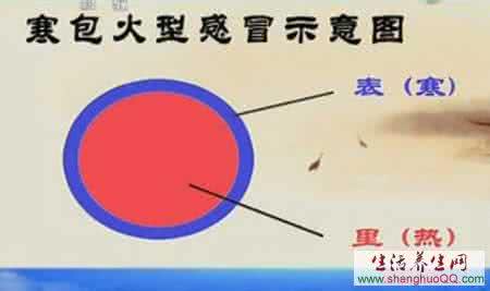 周宝宽新浪网中医 寒包火感冒_新浪中医_新浪网