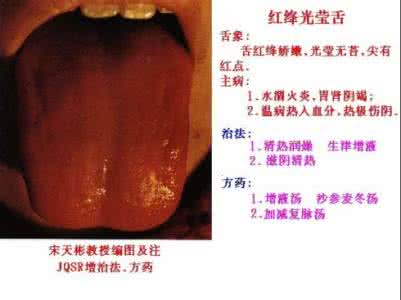 郑子彬 中山大学 教授 【教授图解】宋天彬彬教授图解《舌象+主病+治法+方药》集锦