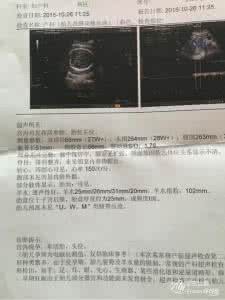 孕晚期b超必须检查什么 孕晚期B超查什么