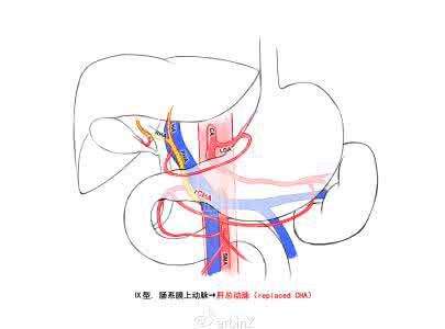 医笔医画：肝动脉之舞