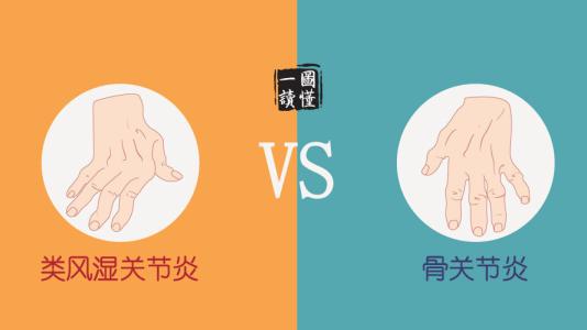 类风湿骨关节炎治疗 一图读懂丨类风湿关节炎 VS 骨关节炎