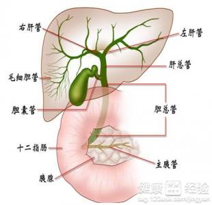 肝内胆管结石怎么治疗 肝内胆管结石治疗 肝内胆管结石怎么办 应该怎么治疗