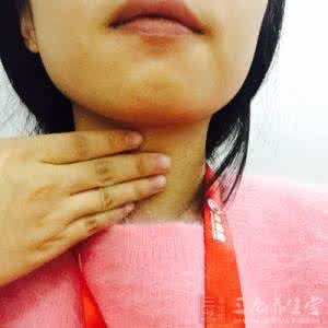 咽喉炎引起的咳嗽 咽喉炎引起的咳嗽1方