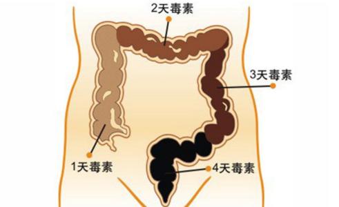 清理肠道宿便最好方法 有什么东西可以清理肠道排宿便吗？