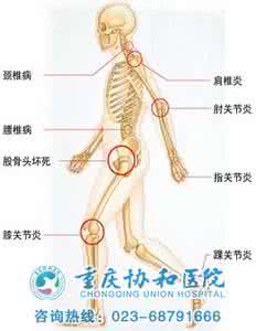 qc七大手法鱼骨图 完全解答：骨、关节七大问