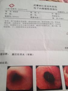 肝硬化最佳治疗方法 (4)治疗肝硬化六世家传秘方