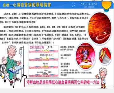 纳豆产品 如何正确认识和选用纳豆产品