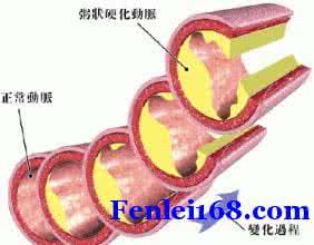 脑供血不足治疗方法 治疗脑供血不足有哪些方法