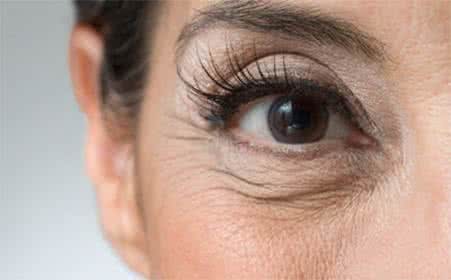 如何去除眼部皱纹 如何去除眼部皱纹 去除眼部皱纹的法则