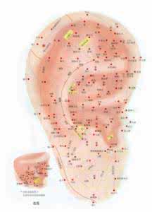 高血压的运动疗法 高血压的耳穴疗法