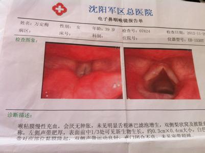 声带粘膜隆起的原因 声带粘膜隆起怎么治疗？