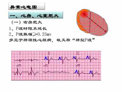 怎样看尿检化验单 怎样看心电图