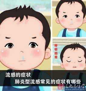 流感的常见症状 流感的症状 肺炎型流感常见的症状有哪些