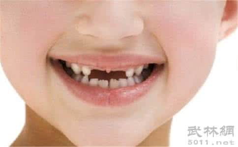 做梦梦到掉牙 做梦梦到掉牙 做梦掉牙是怎么回事