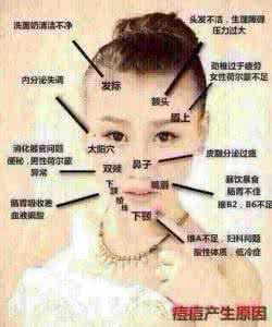 脸颊长痘痘怎么调理 右脸颊长痘的调理方法 抗痘四部曲