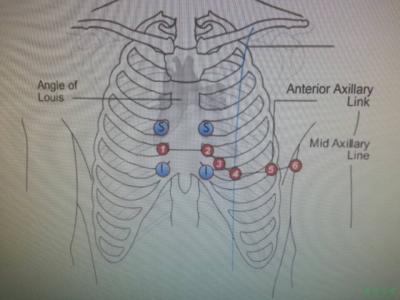十二导联心电图位置 心电图导联位置 十二导联的位置