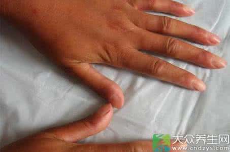皮肤硬皮病 图文:皮肤外用药之硬皮病外敷散