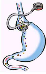 肠胃动力不足怎么办 肠胃动力不足需补充消化酶