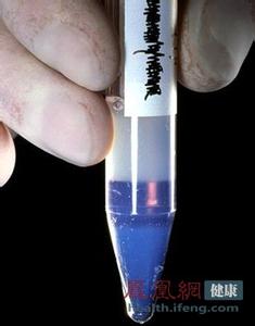男性荷尔蒙的味道 男性精液的味道与健康状况的联系