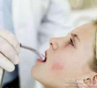 治疗慢性咽炎的偏方 治疗咽炎的偏方 如何预防咽炎