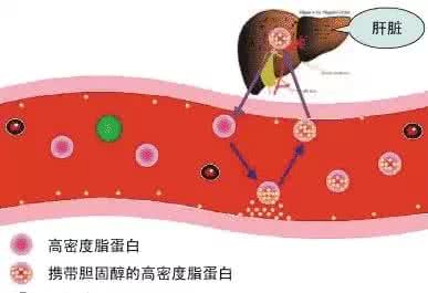 降血脂与血管斑块 降血脂与血管斑块 血脂“正常”血管也会堵 别被你的体检结果骗了