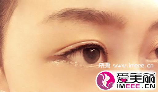 种植睫毛注意事项 种睫毛前注意事项 有7点要注意
